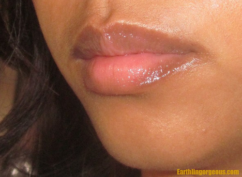 lip windburn